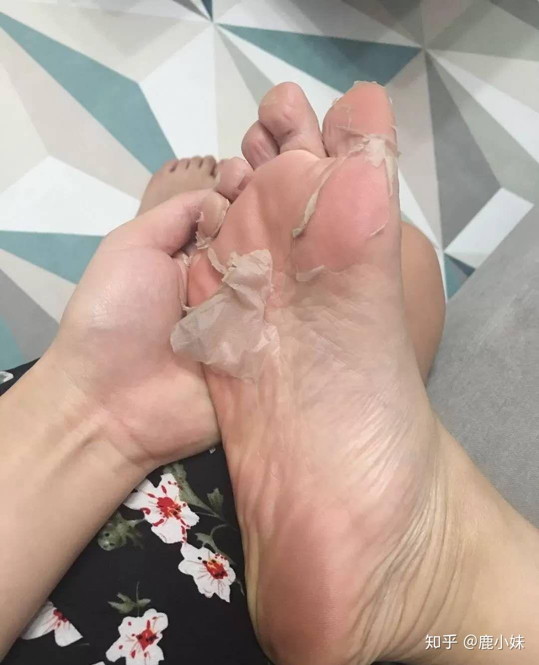 姐姐们能不能提供一下保养脚的方法啊? - 知乎