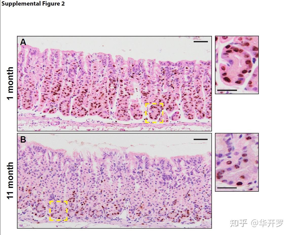 单层柱状上皮含有杯状细胞,胃黏膜上皮为单层柱状上皮,可为什么说正常