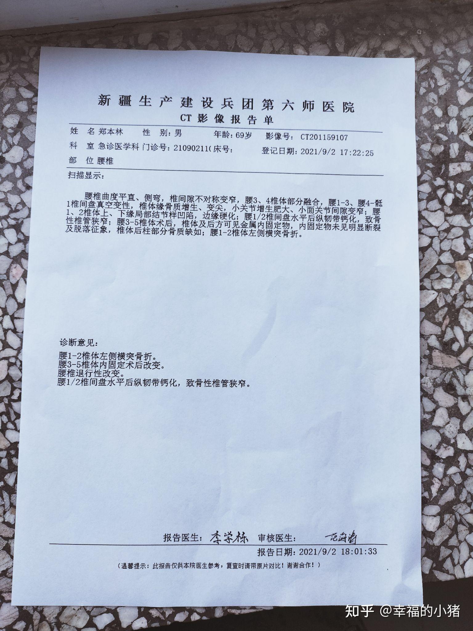 车祸一根肋骨骨折赔偿多少? - 知乎