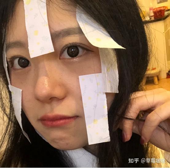 脸上长斑怎么办?-脸部长斑怎么内调