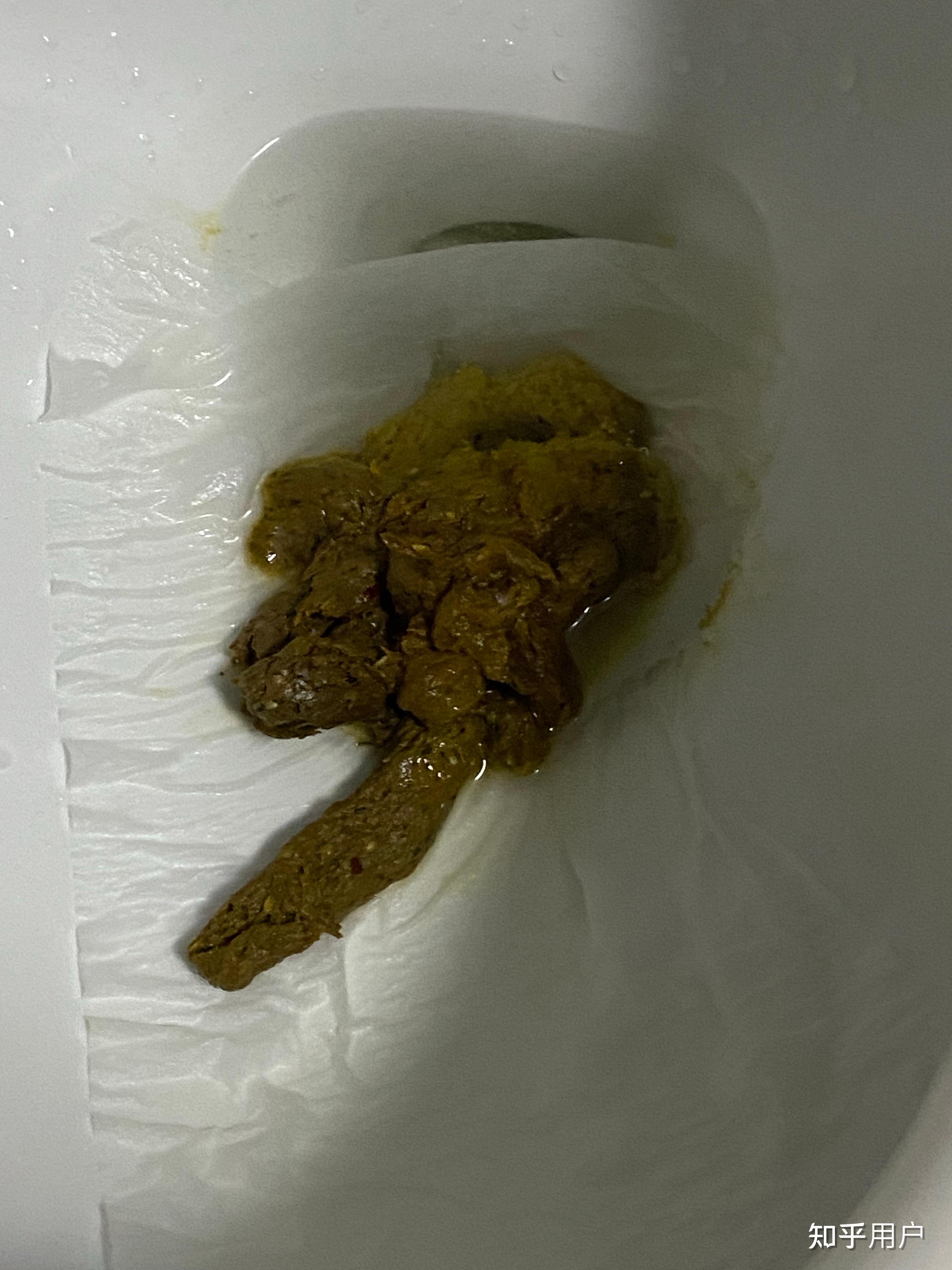 大便哪种状态表示身体最健康?