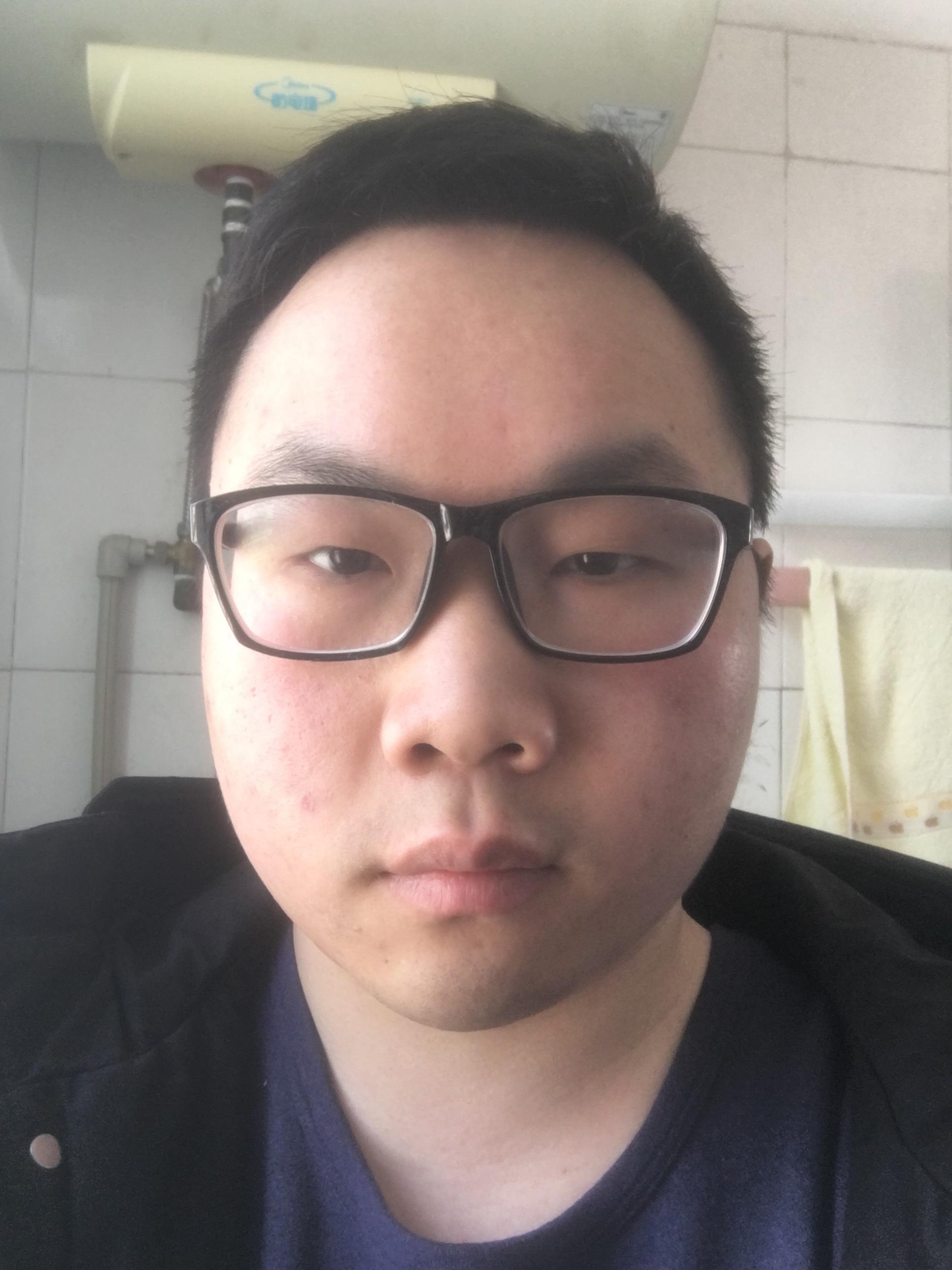 有没有长得丑的男生照片分享一下.我想知道什么样算丑 ?