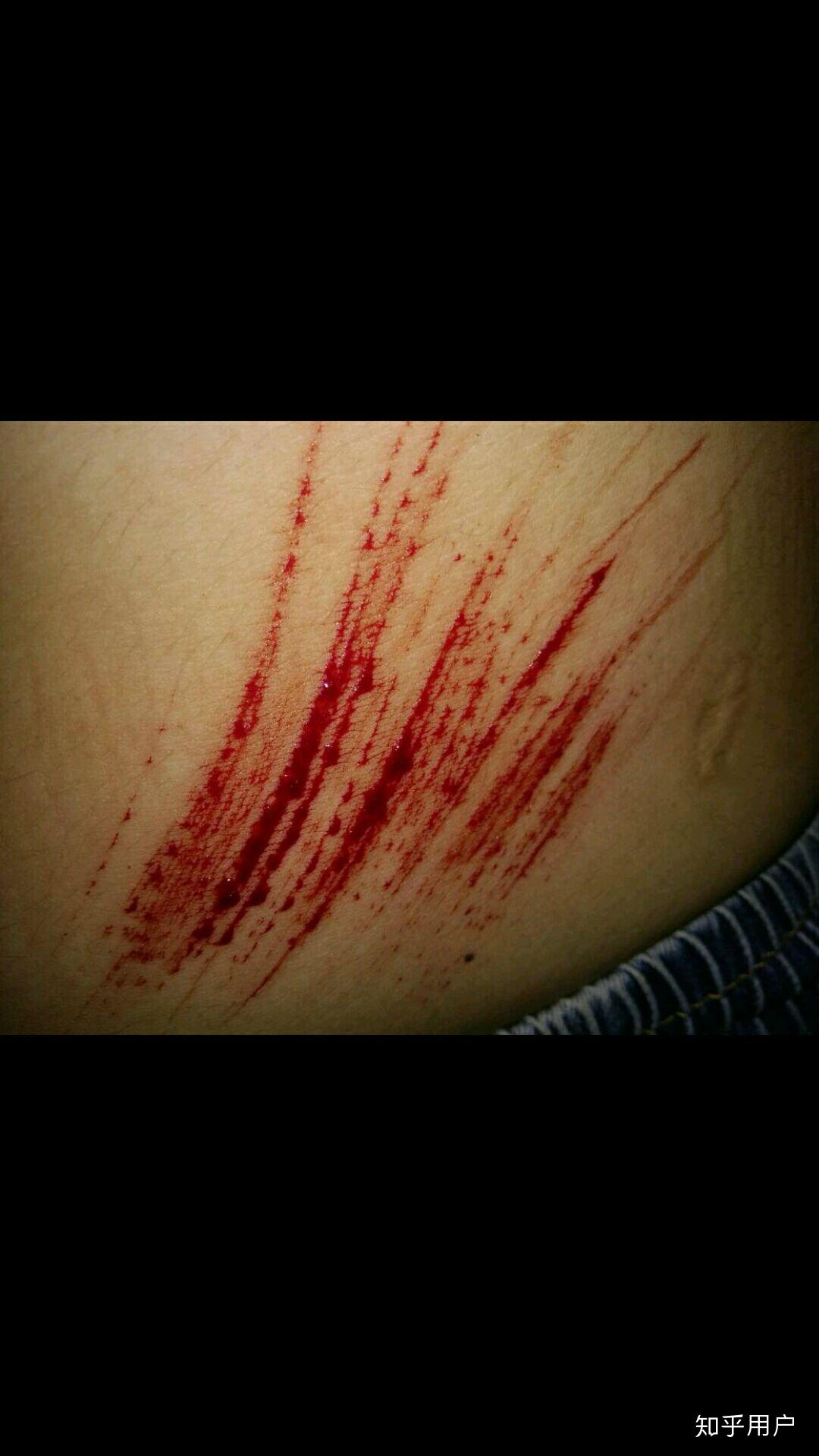 自残属于什么心理