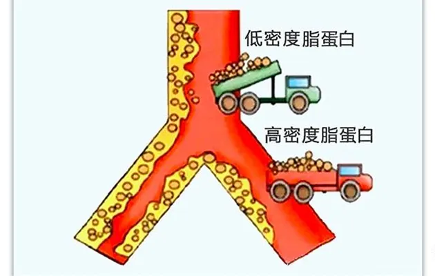高/低密度脂蛋白(上)