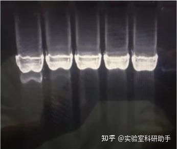 琼脂糖凝胶电泳条带分析秘籍:从条带识别到结果解读! - 知乎