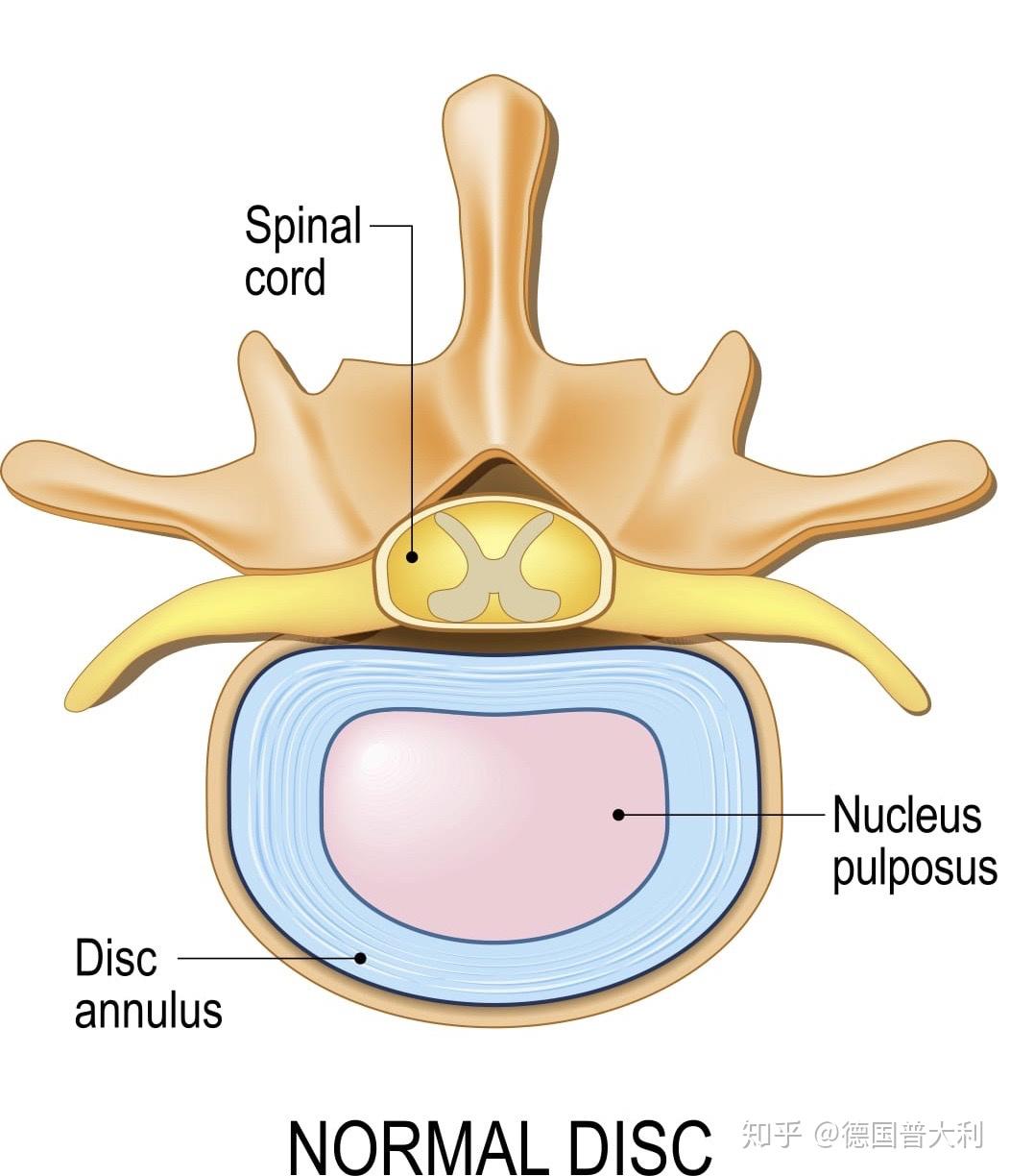 c3/4颈椎椎间盘突出都有哪些治疗手段? - 知乎