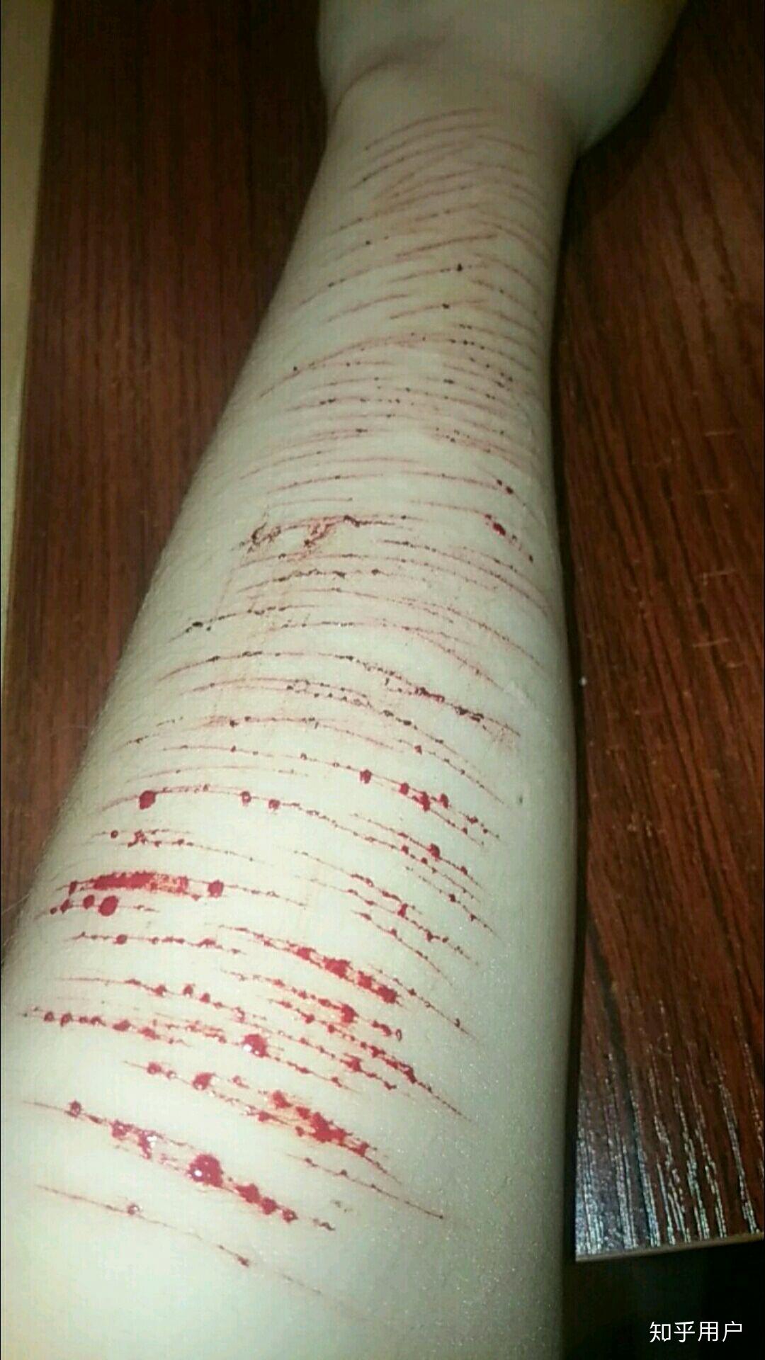 自残属于什么心理