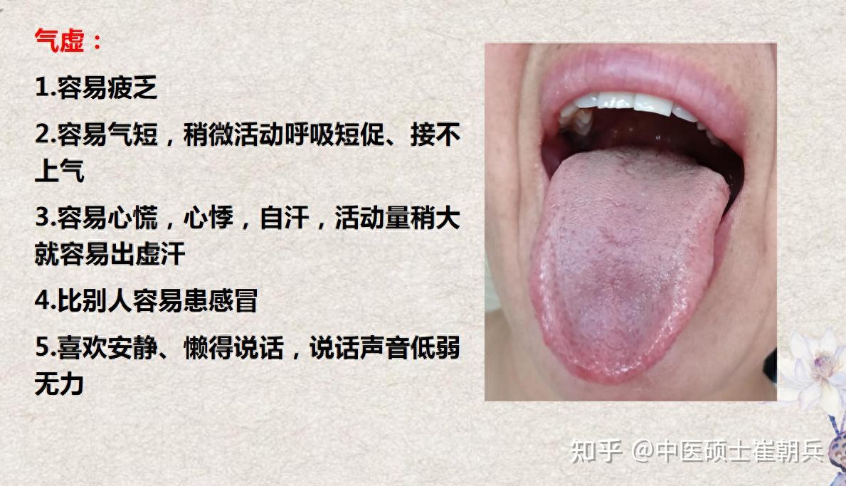 肾阴虚、肾阳虚、气虚、血虚症状和舌象都是什么样呢 - 知乎