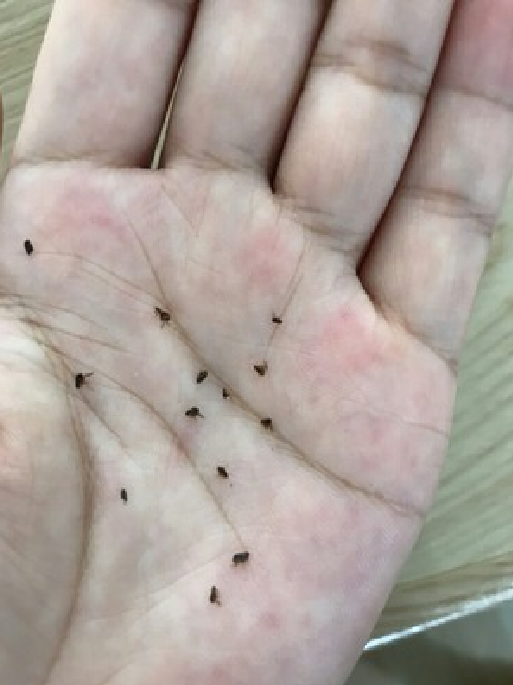 被跳蚤咬的家都不想住了有什么办法灭了它们