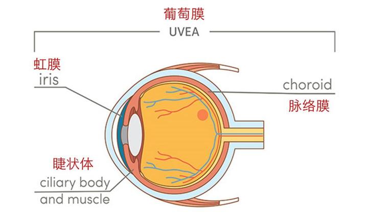 葡萄膜炎你竟如此不同一篇關於葡萄膜炎包括虹膜炎的正經科普