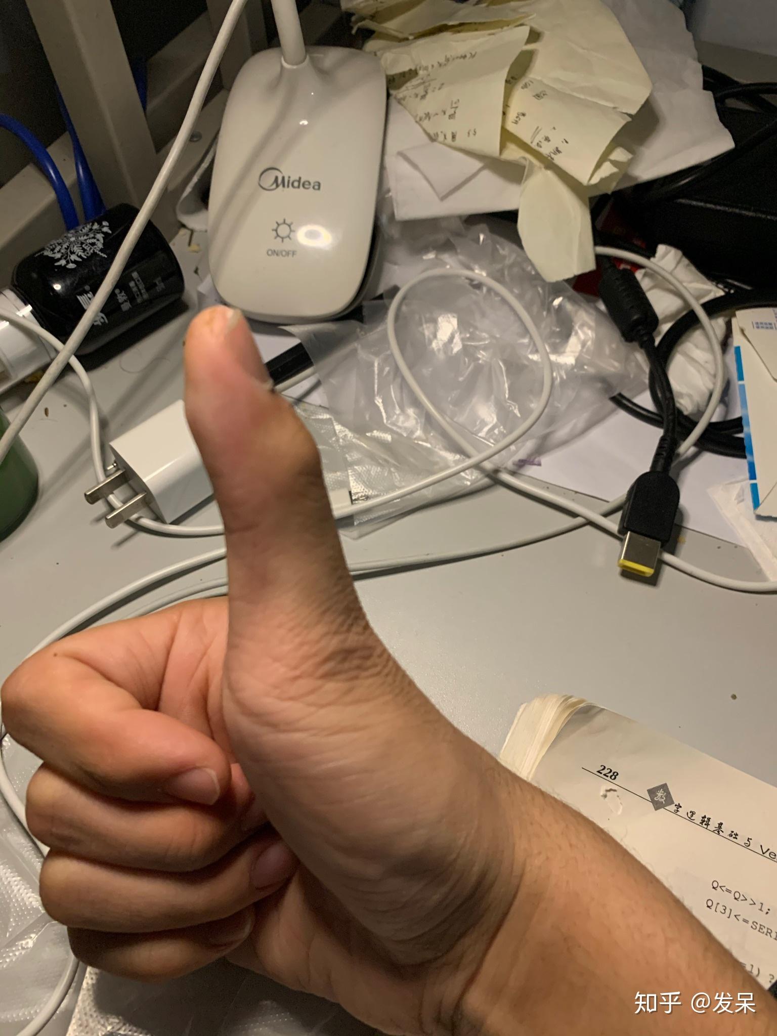 打篮球手指被戳了一下可能错位了能自己恢复吗