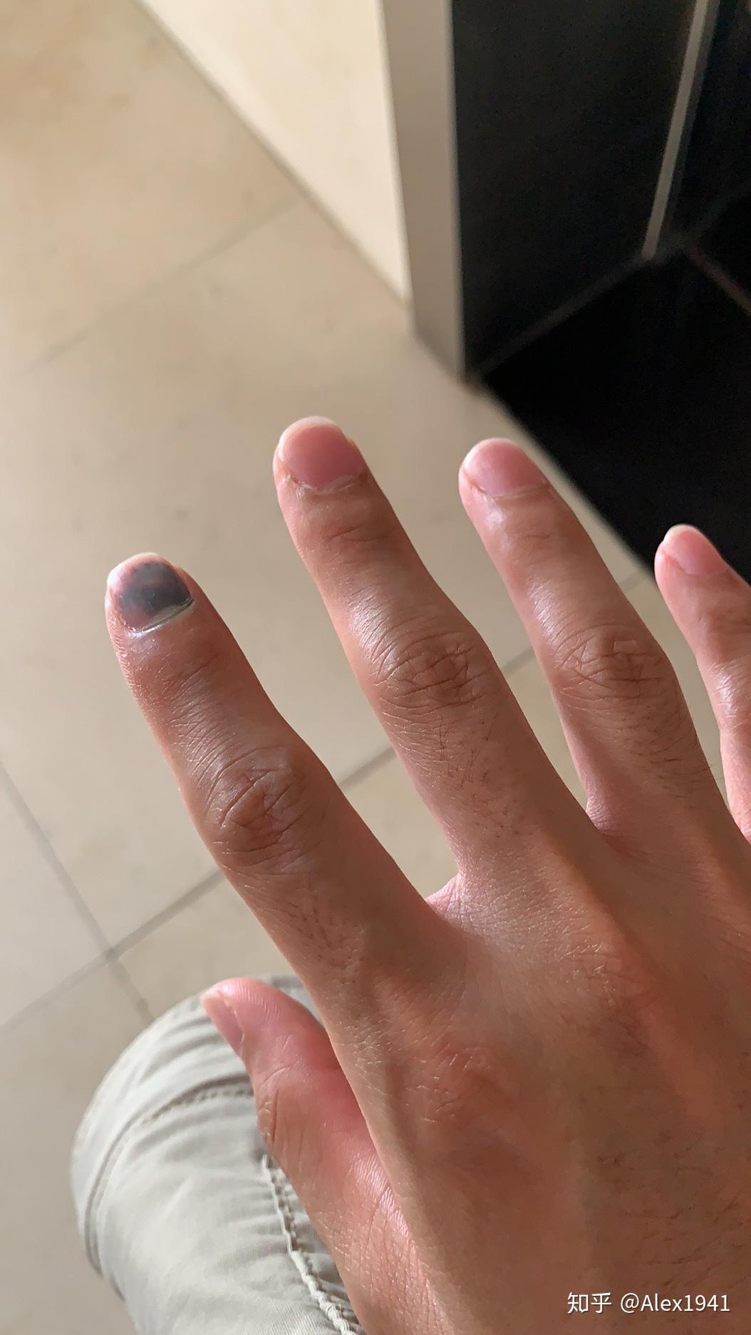 右手手指被门夹是种什么感受? - 知乎