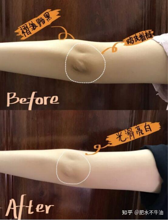 夏天到了怎么防晒和美白