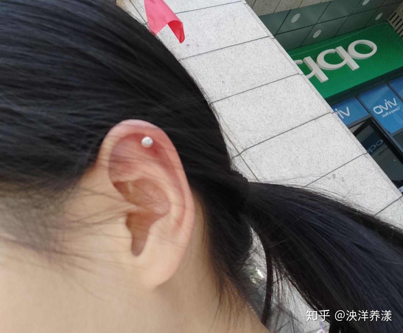 刚打完耳洞一周因为发现里面有脓所以摘下来消毒结果