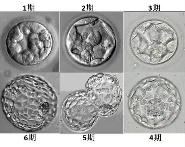 什么是鲜胚冻胚和囊胚