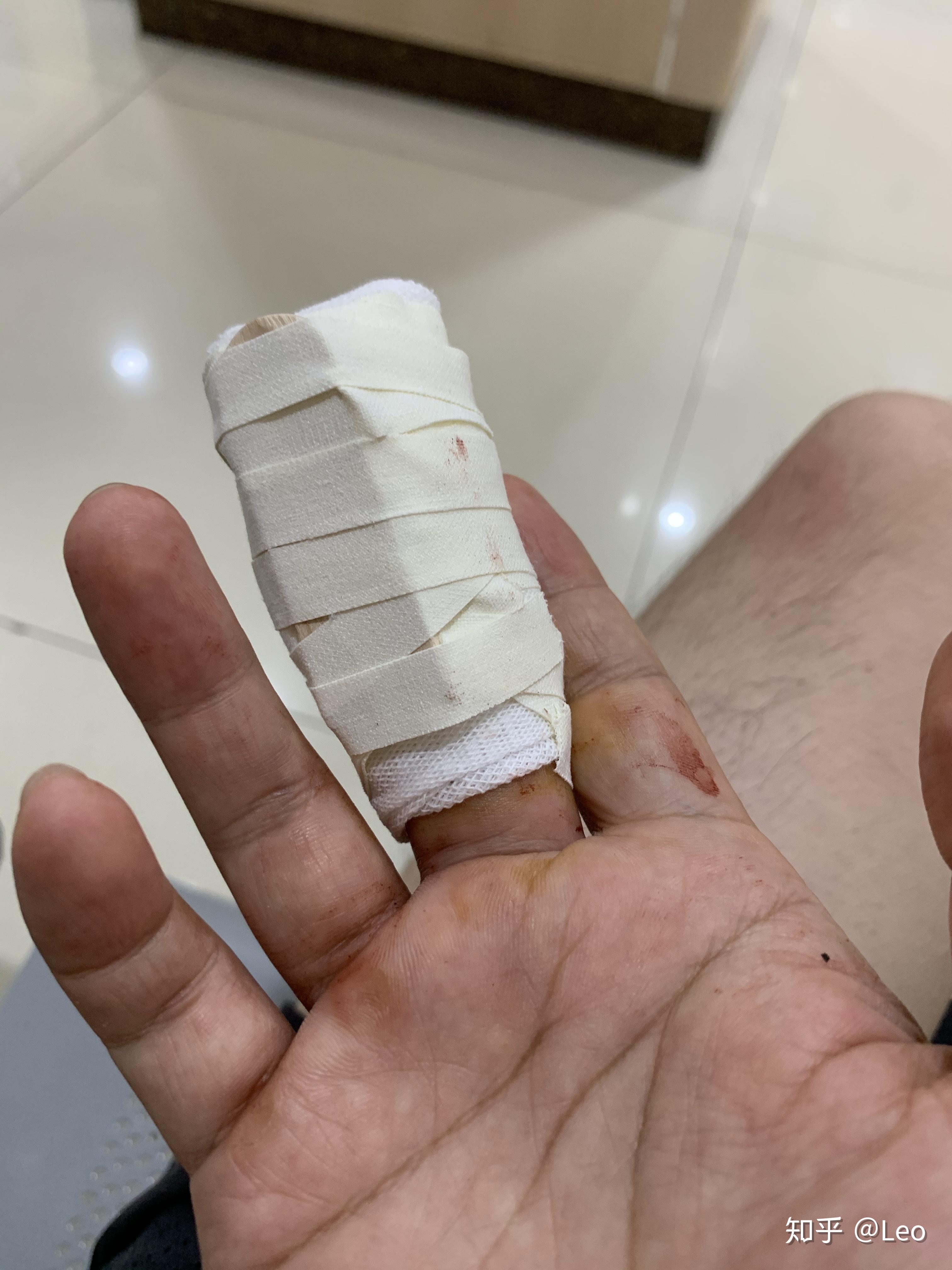 被10kg的哑铃砸到手指是怎样一种感受