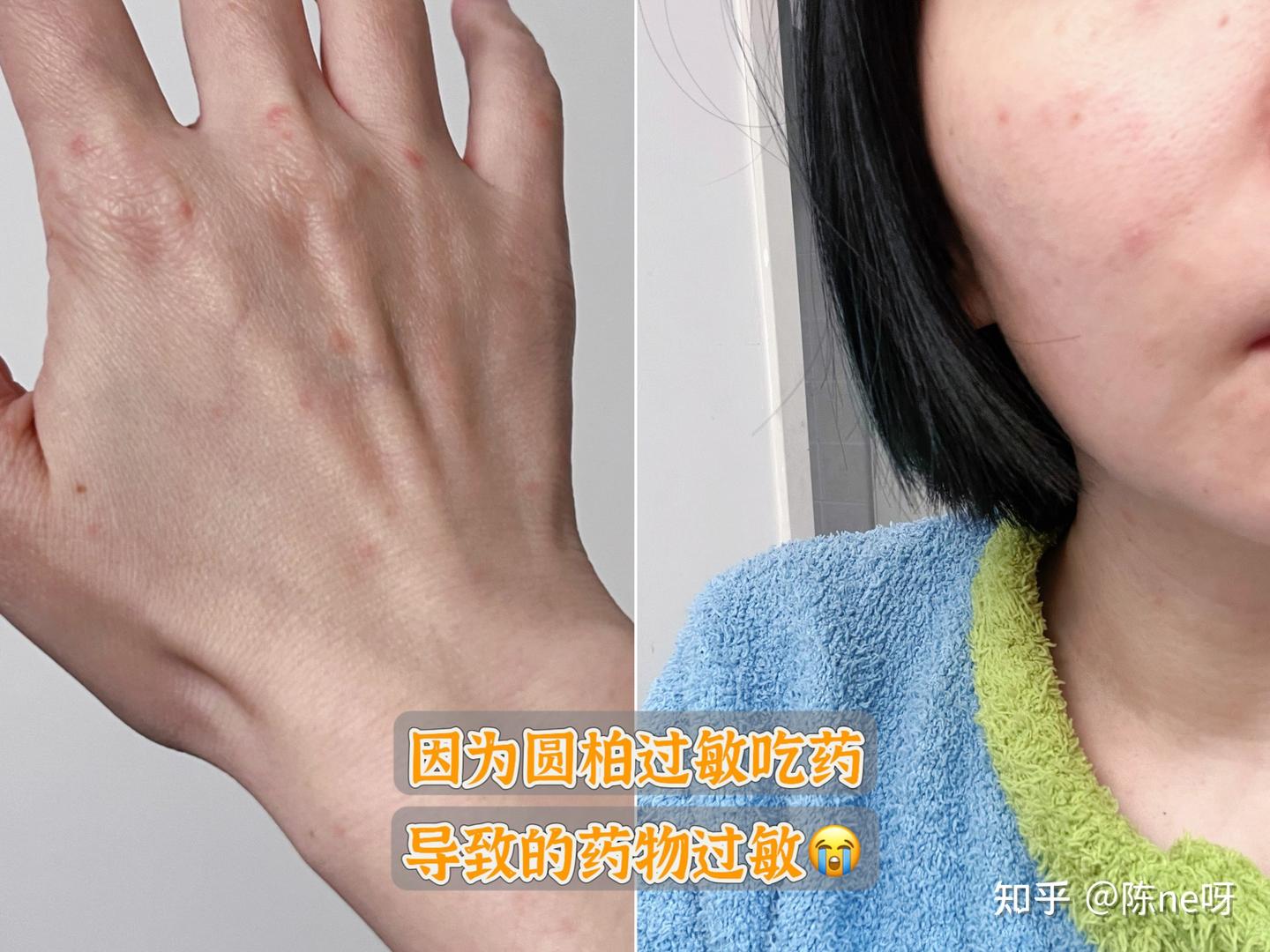 家里有扫地机还不够?过敏后,我终于把家里这处清洁死角补上了|追觅Z20 Station旋锋版实测