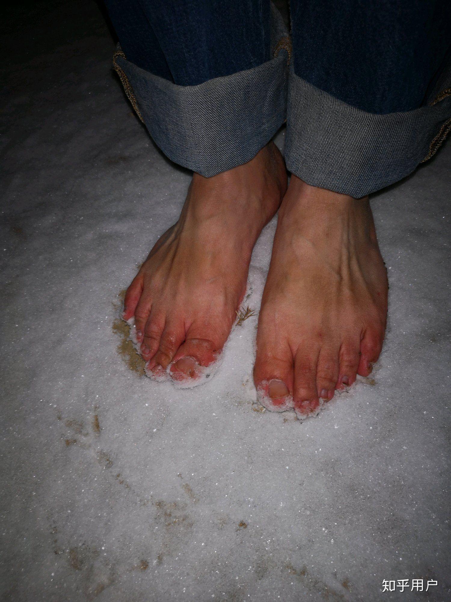 光脚踩雪地或光脚在雪地里奔跑是什么体验